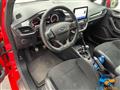 FORD FIESTA 1.5 Ecoboost 200 CV 5 porte ST