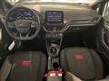 FORD FIESTA 1.0 Ecoboost Hybrid 125 CV 5 porte ST-Line