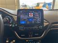 FORD FIESTA 1.1 85 CV 5 porte ST-Line  **NEOPATENTATI**