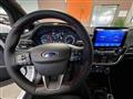 FORD FIESTA 1.0 Ecoboost Hybrid 125 CV 5 porte ST-Line