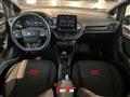 FORD FIESTA 1.0 Ecoboost Hybrid 125 CV 5 porte ST-Line