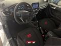 FORD FIESTA 1.0 Ecoboost Hybrid 125 CV 5 porte ST-Line