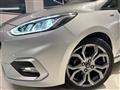 FORD FIESTA 1.5 EcoBlue 5 porte ST-Line