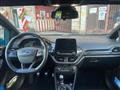 FORD FIESTA 1.0 Ecoboost 100 CV 5 porte ST-Line